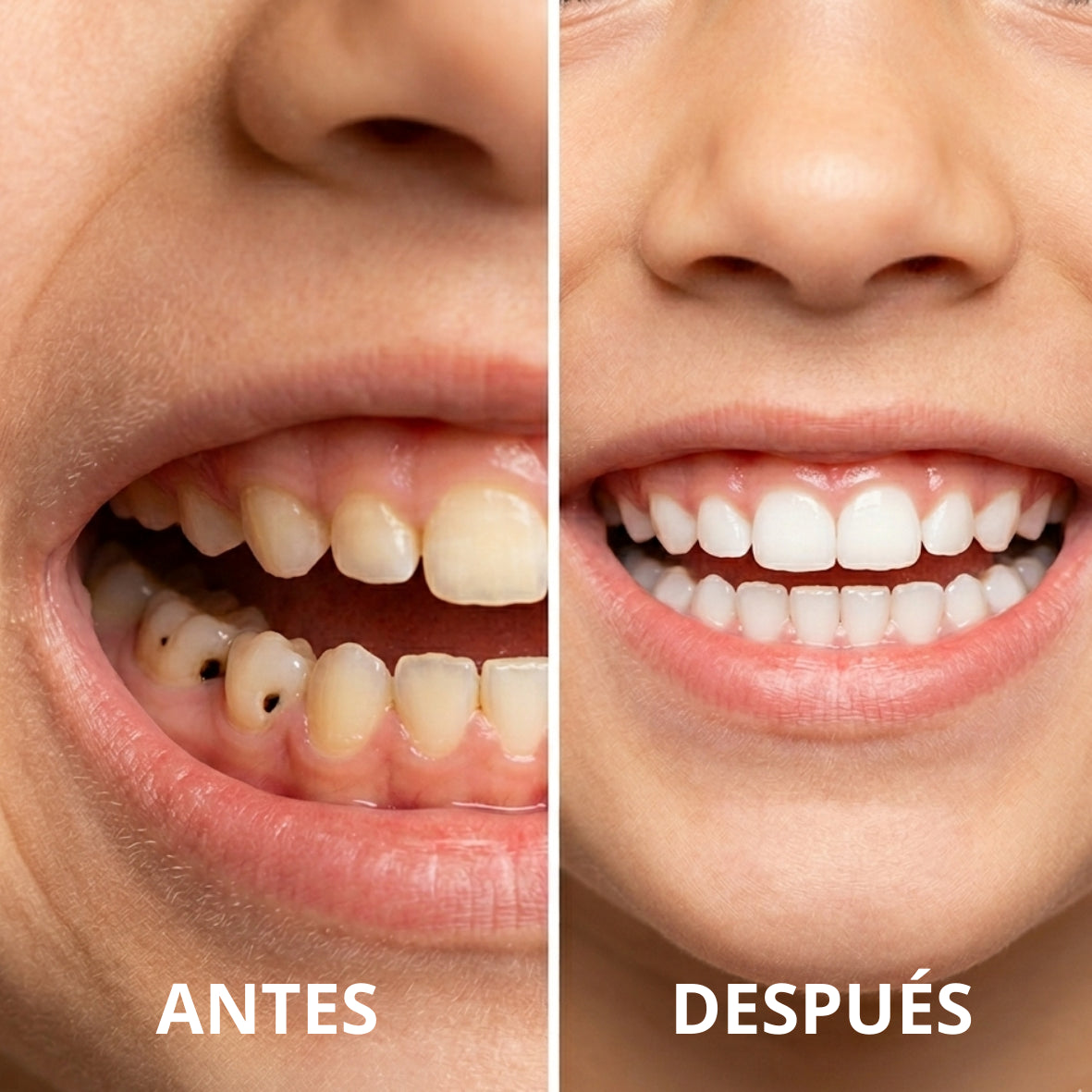 SUNNYSMILE™ Dientes perfectos en 30 segundos.