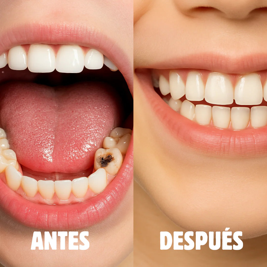 SUNNYSMILE™ Dientes perfectos en 30 segundos.